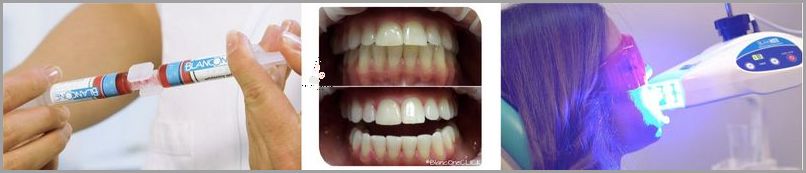 10 Minut Do Białych Zębów!