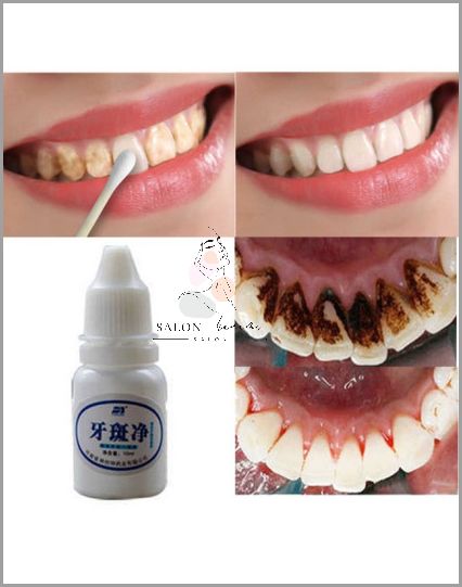 10 Minut Do Białych Zębów!