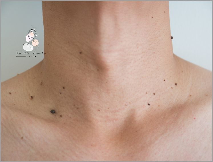 10 Minut Na Solarium A Ty Wiesz Ile To Na Słońcu?