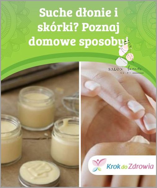 7 Domowych Sposobów Na Suche Dłonie!