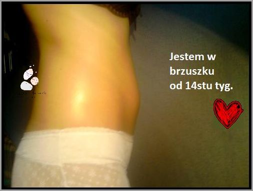 7 Naturalnych Sposobów na Rozstępy W Ciazy!