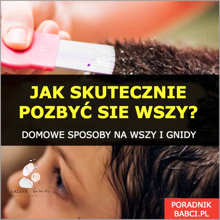 Babcine Sposoby Na Odciski - Skuteczne!