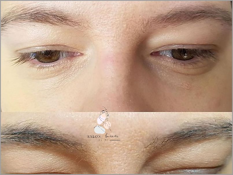 Biotebal - Niesamowite Efekty Odżywki Do Rzęs! Biotebal - Niesamowite Efekty Odżywki Do Rzęs!