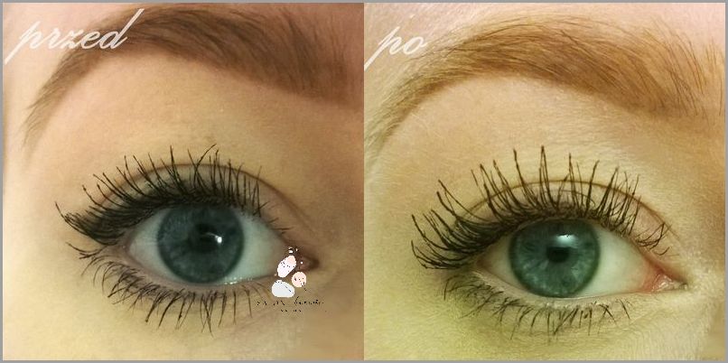 Biotebal - Niesamowite Efekty Odżywki Do Rzęs! Biotebal - Niesamowite Efekty Odżywki Do Rzęs!