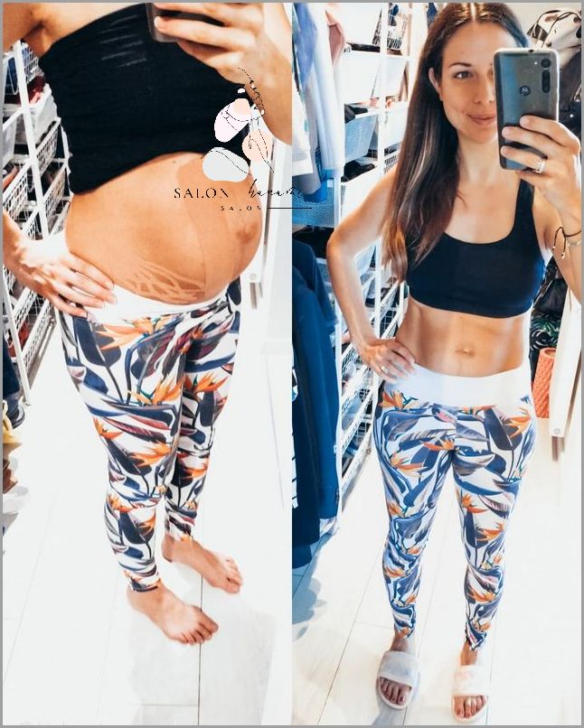 Co Kreska Na Brzuchu W Ciąży Oznacza?