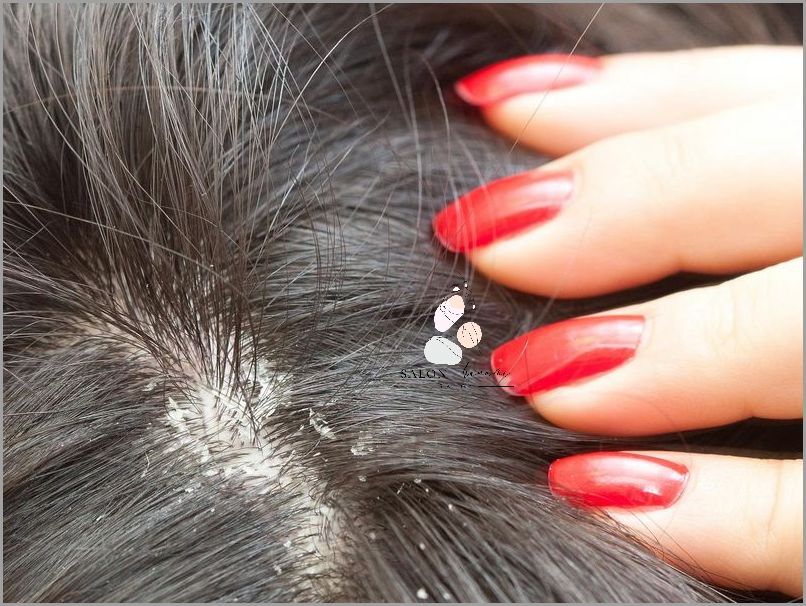 Cudowne Efekty Stosowania Czarnej Herbaty Na Włosy!