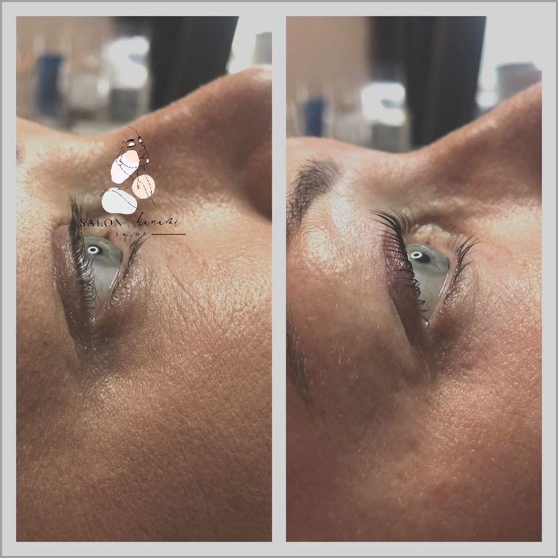 Czy Można Przedłużyć Rzęsy Po Liftingu?