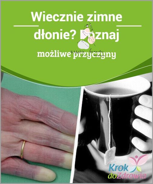 Dlaczego Pocące Się Dłonie Są Problemem? Dlaczego Pocące Się Dłonie Są Problemem?