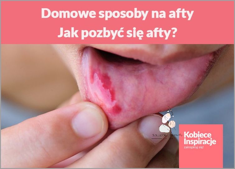 Domowe Sposoby na Brodawki Łojotokowe!