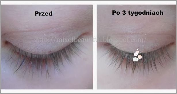 Efekty Używania Aloesu Na Twarz - Co Się Stało?