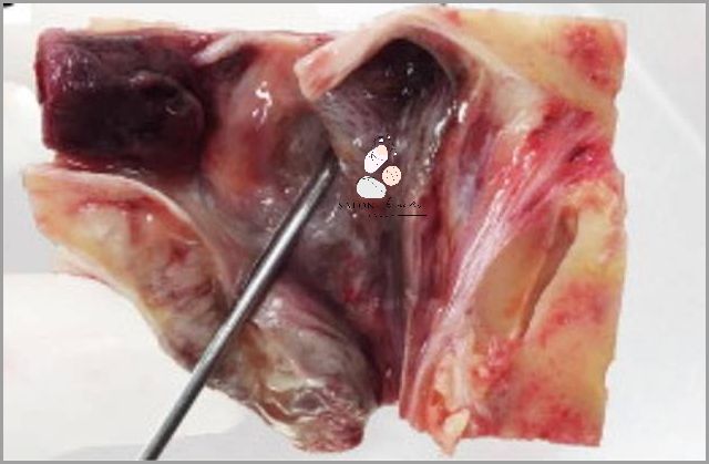 Gdzie Człowiek Ma Najwięcej Gruczołów Potowych?