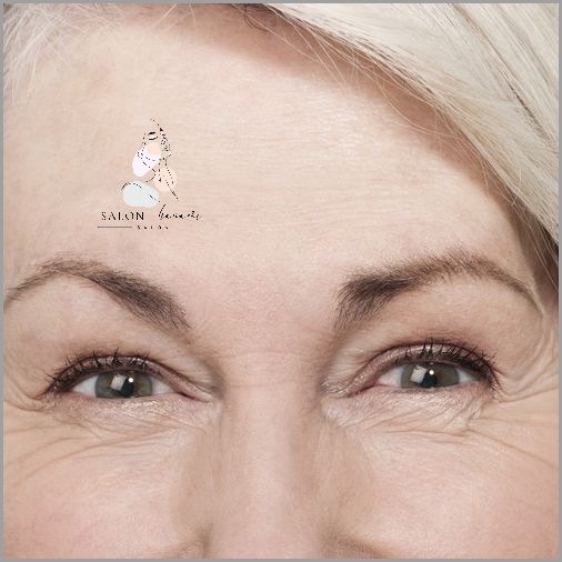 Jak Ja Pozbyłam Się Zmarszczek!