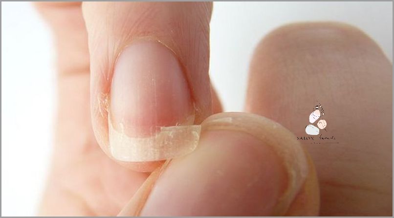 Jak Pobudzić Łożysko Paznokcia? Sprawdź!