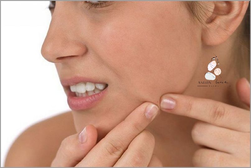 Jak Pozbyć Się Pryszczy Na Brodzie Od Maseczki?