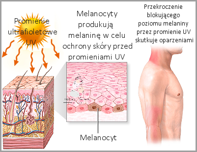 Jak Skutecznie Leczyć Oparzenia Słoneczne? Coś Na To!
