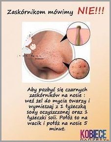 Jak Skutecznie Pozbyć Się Czarnych Kropek Na Nosie?