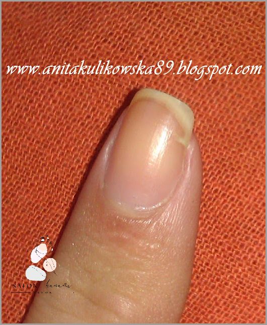 Jak Uratować Złamany Paznokieć? Przekonaj Się! Jak Uratować Złamany Paznokieć? Przekonaj Się!