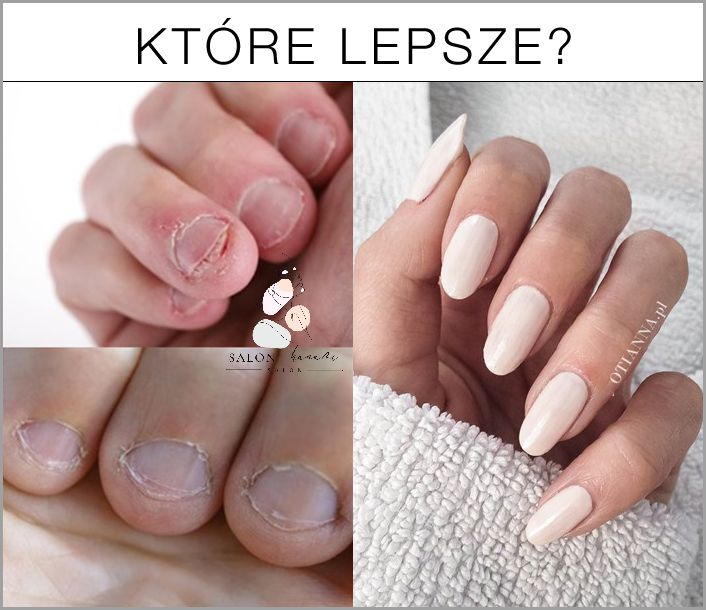 Jak Usunąć Skórki Z Paznokci? Sprawdź Teraz!