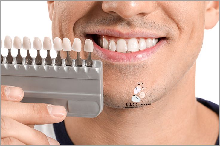 Jak Zatruć Zęba W Domu? Sprawdź!