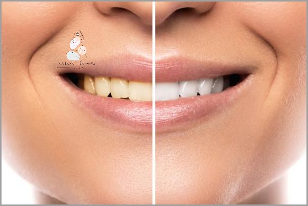 Jak Zatruć Zęba W Domu? Sprawdź!