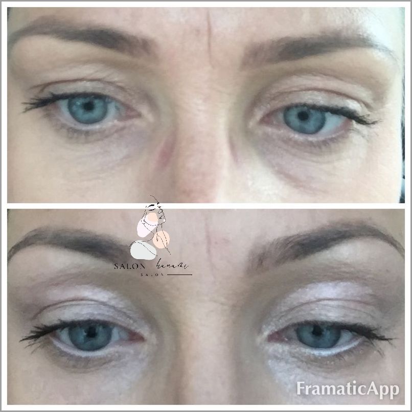 Jak Zrobić Kreski Na Opadające Powieki? Jak Zrobić Kreski Na Opadające Powieki?