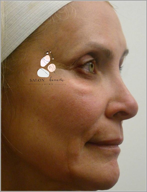 Jaki Kolagen Wybrać Na Zmarszczki? Sprawdź!