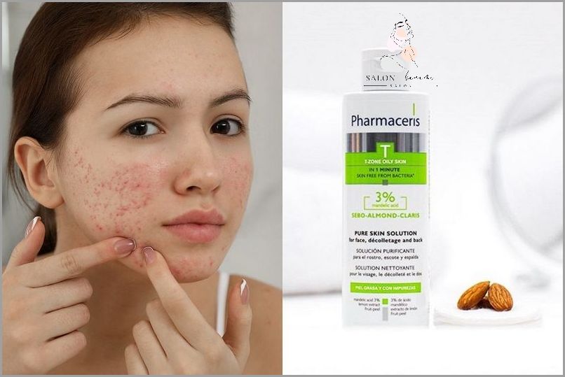 Krem Na Oparzenia Słoneczne - Zaskakująco Skuteczny!