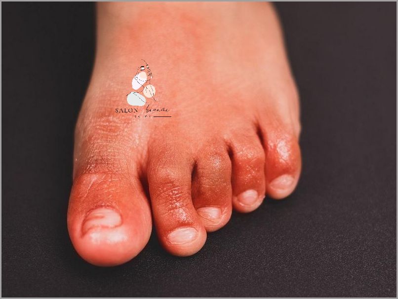 Kuriozalny Przypadek Krzywych Palców U Rąk! Kuriozalny Przypadek Krzywych Palców U Rąk!