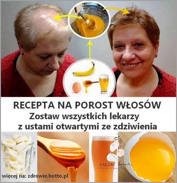 Kwas Hialuronowy Na Włosy - Cuda Czyni!