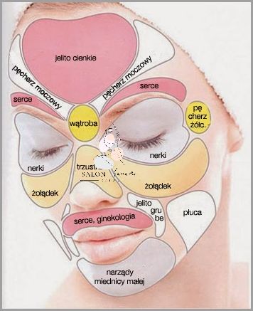 Lekarze Zdumieni: Ropne Pryszcze Na Twarzy!