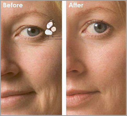 Masaz Odmładzający Twarzy - Zaskakujące Efekty!