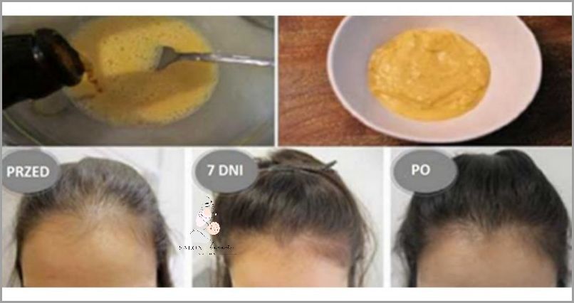 Maseczka Z Jajka - Co Mówią Użytkownicy o Włosach?