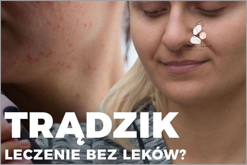 Najlepsze Kremy Na Trądzik - Sprawdź, Co Ci Pomaga! Najlepsze Kremy Na Trądzik - Sprawdź, Co Ci Pomaga!