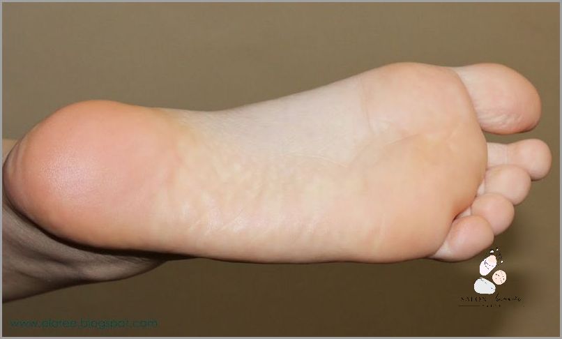 Nie Możesz Uwierzyć! Skarpetki Złuszczające Na Pięty!