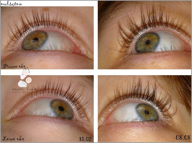 Niesamowite Efekty Po Użyciu Long 4 Lashes Włosy!
