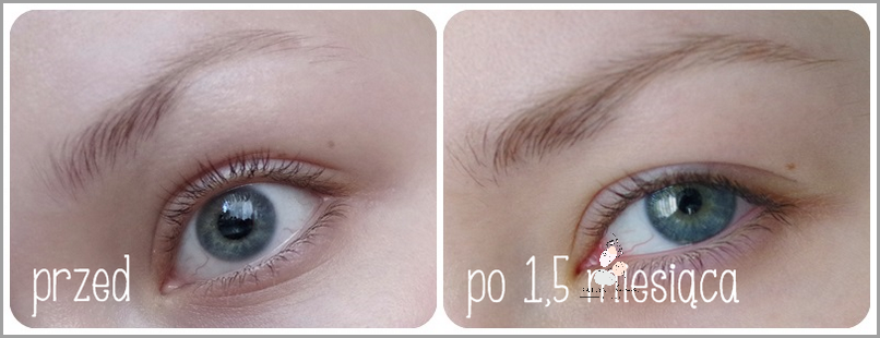 Niesamowite Efekty Po Użyciu Long 4 Lashes Włosy!