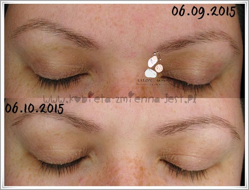 Odkryj Efekty Uboczne Odżywki Do Rzęs!