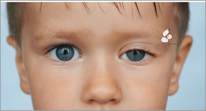 Ostrzegamy: Jak Wygląda Opadająca Powieka?