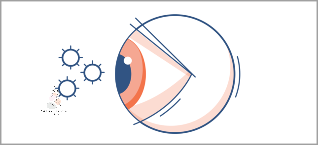 Pieczenie Twarzy I Oczu? Sprawdź, Co Może Ci Pomóc!