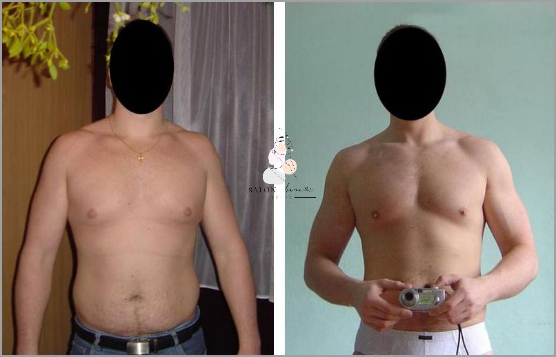 Pomocy! Ból Podbrzusza Po Miesiączce - Forum