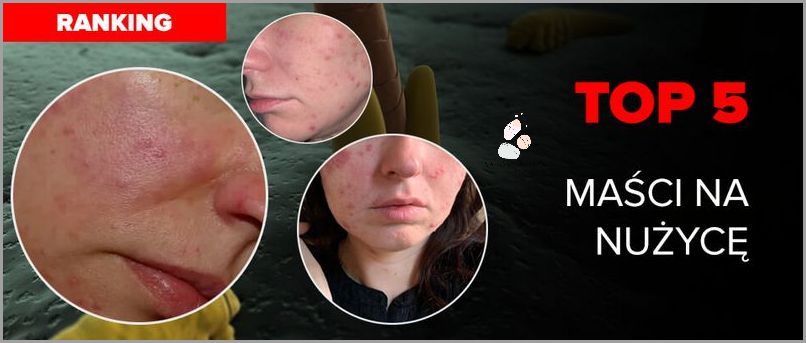 Ranking Kremów Ujędrniających Brzuch!
