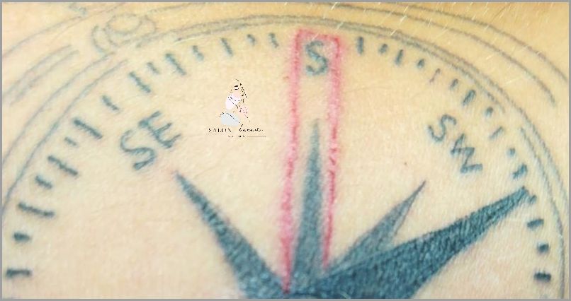 Rozlany Tatuaż Pod Folią - Co Teraz?