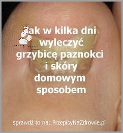 Sekretny Przepis na Leczenie Chorób Paznokci U Rąk!