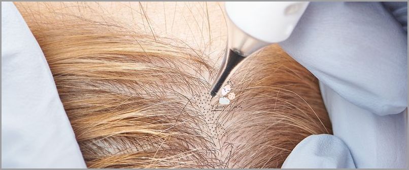 Skuteczna Metoda Przerzedzania Włosów Z Przodu Głowy!