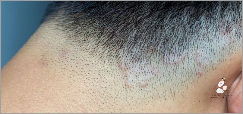 Stres? To może być przyczyną wypadania włosów! Stres? To może być przyczyną wypadania włosów!