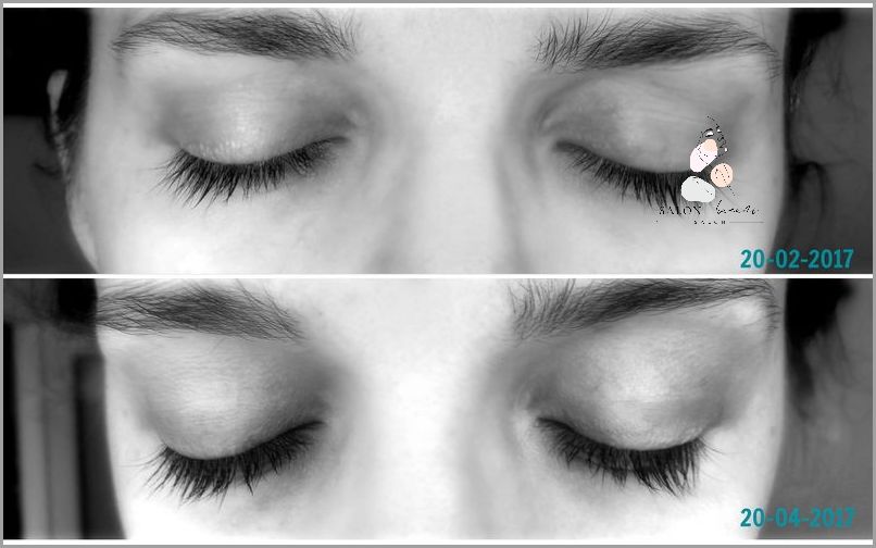 Szokujące Efekty: Witaminy Na Rzęsy!