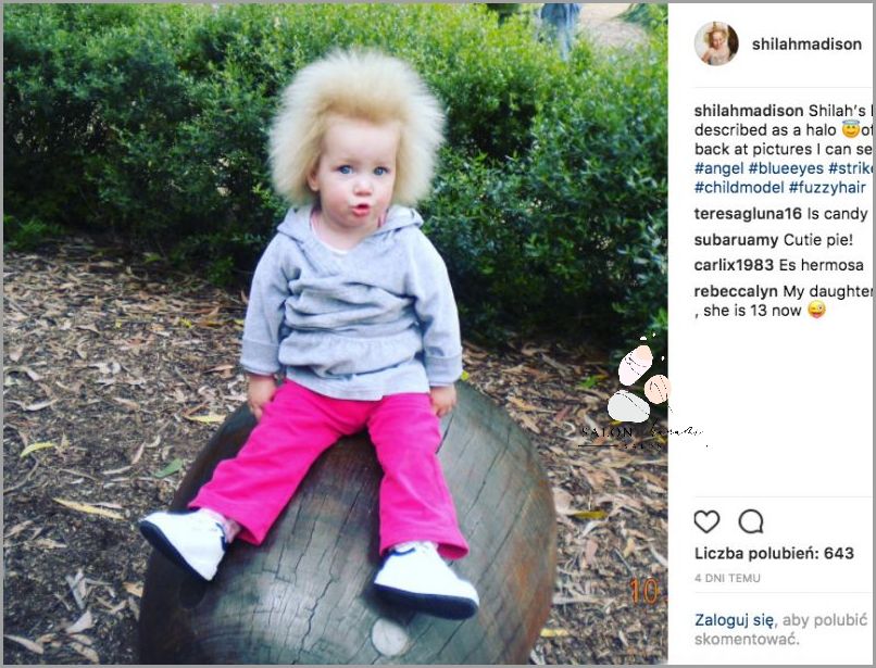 Tajemniczy Zespół Włosów Niedających Się Uczesać!