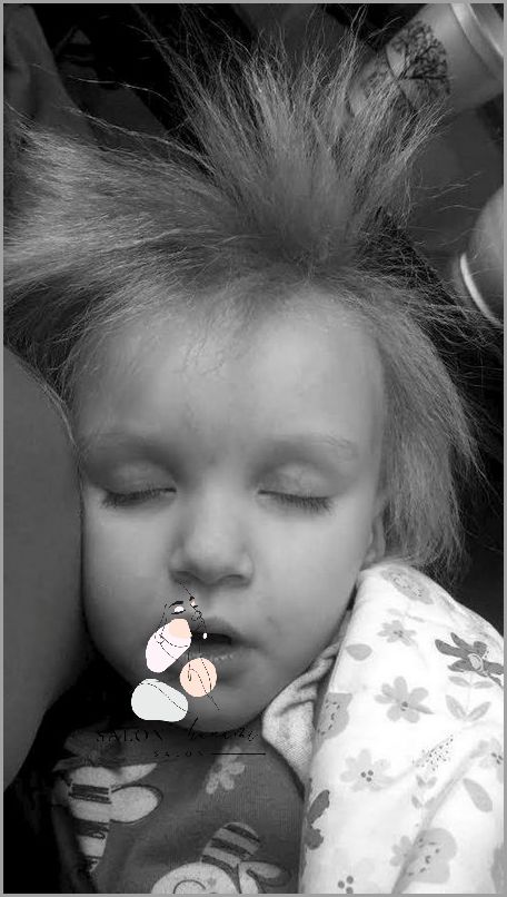 Tajemniczy Zespół Włosów Niedających Się Uczesać!