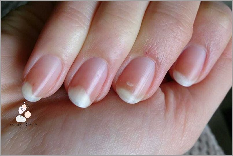 Uczulenie Na Paznokcie Żelowe: Uwaga!