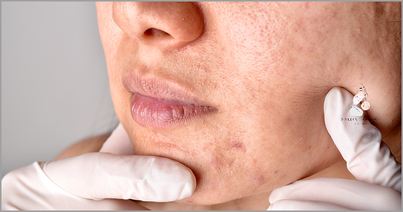 Ujawnione: Przyczyny Opuchniętej Twarzy!